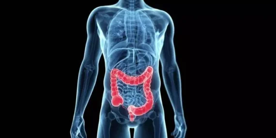 Bu Belirtiler Kolon Kanseri İşareti Olabilir