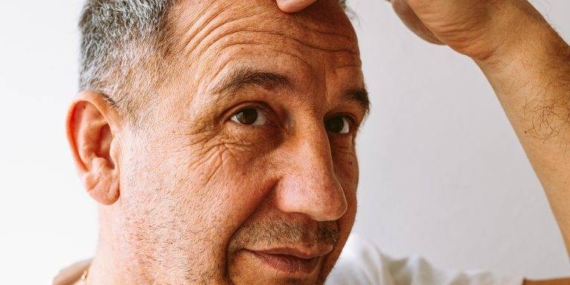 middle-aged-man-demonstrates-gray-hair-hair-loss-2023-03-18-02-56-18-utc-768x768